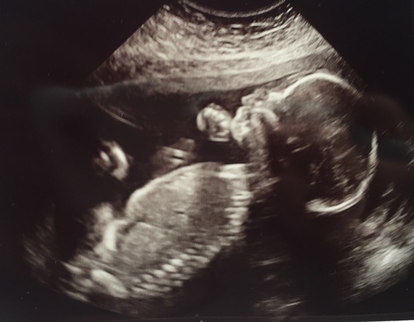 Due February 2017 - thread #7