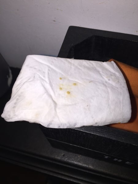 Who loves tonsil stones