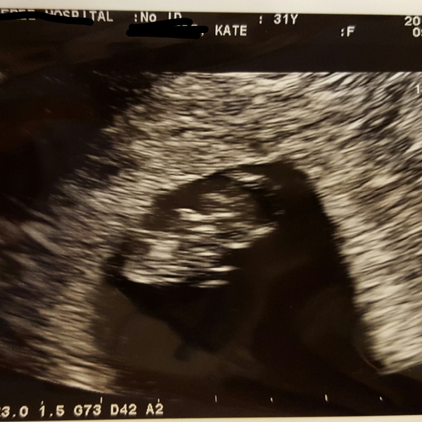 Has anyone NOT mc? :(