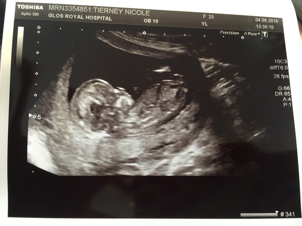 Boy or girl?!