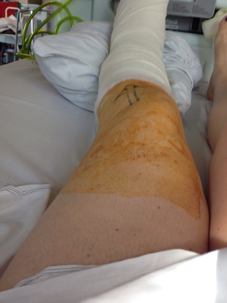 To enjoy being in hospital?