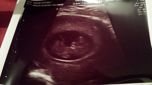 Thread 11. TTC #1 Grads, Babies Arriving Or 'Look At What I Made With My Genitals!'