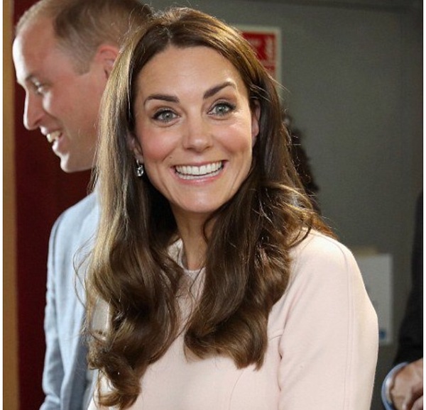 Kate's had botox