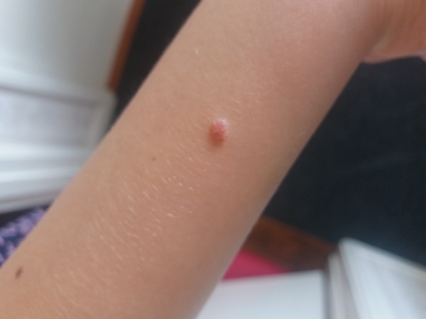 Moles