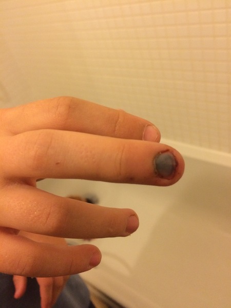 To not take DS to A&E