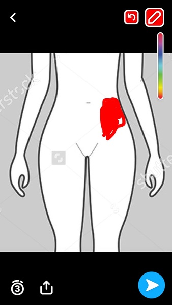 Weird pain at 14 weeks