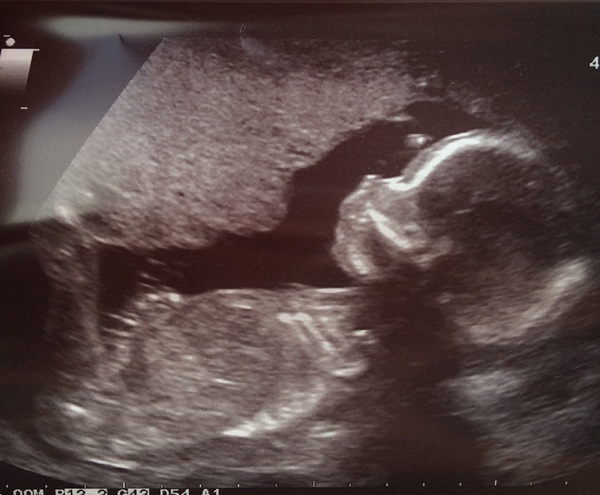 Due February 2017 - Thread 8!