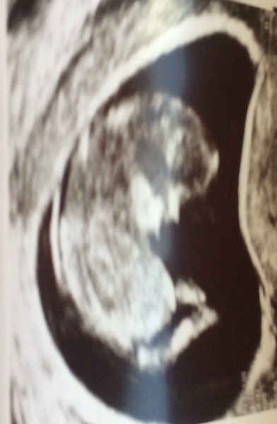 Due in March 2017 - thread #4