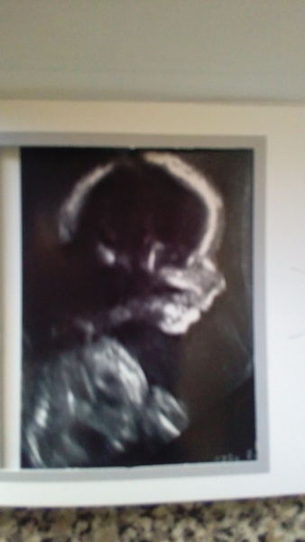 Due February 2017 - thread #7