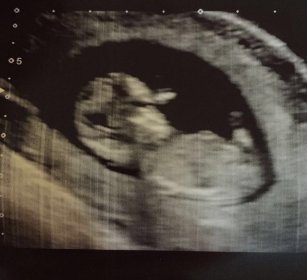 Thread 12 TTC#1 Grads. "You are my favourite thing that ever shit all over my hands"