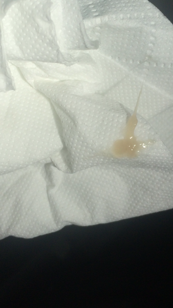 Warning graphic picture tmi cervical mucus