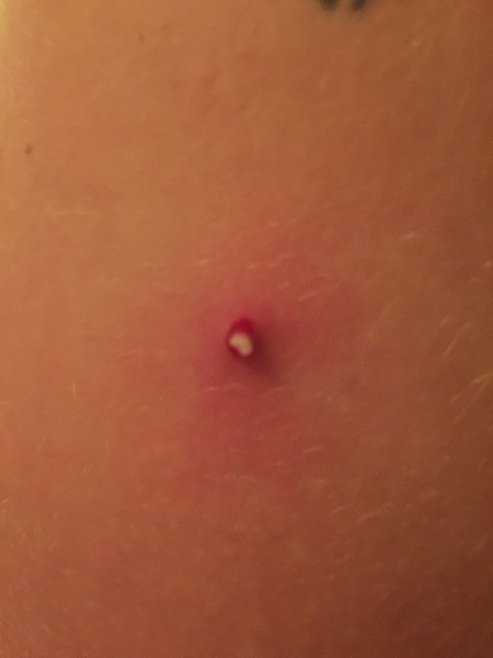 KLAXON DP is growing something