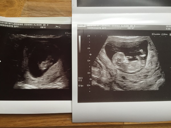 Gender predictions can anyone help?
