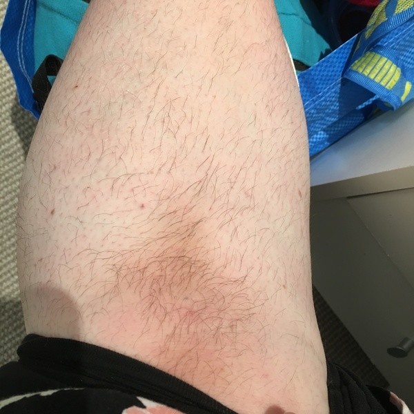 Fellow werewolves - can your leg hair beat mine?