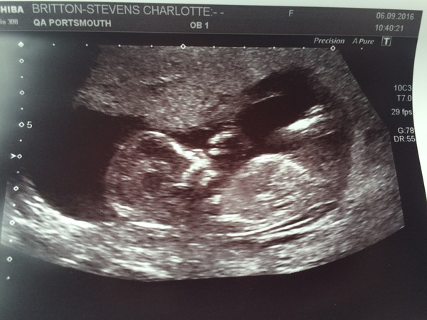 Due in March 2017 - thread #4