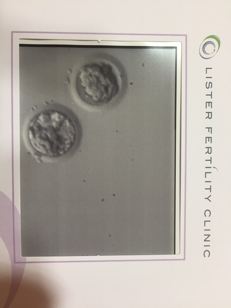 The mind numbing boredom of infertility III