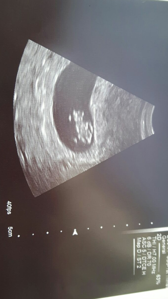 May 2017 - anybody out there?