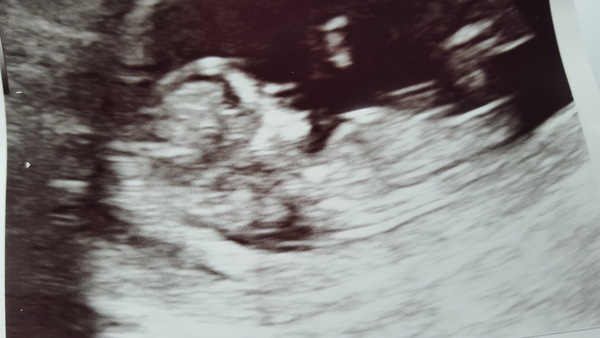 Due in March 2017 - thread #4