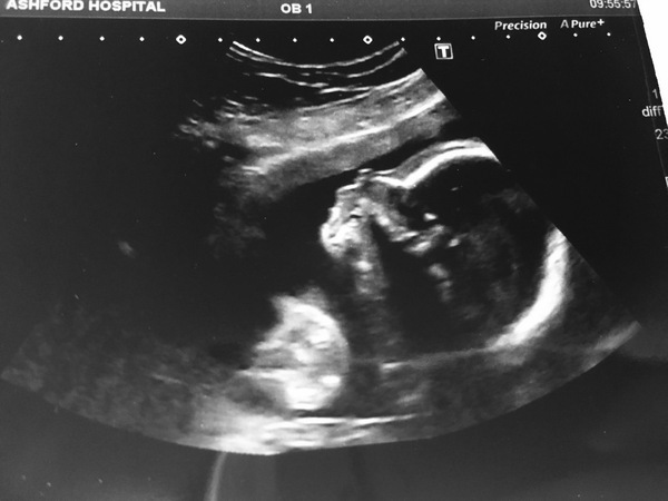 Due February 2017 - thread #7