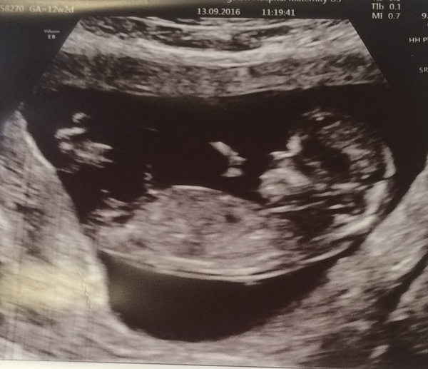 Due in March 2017 - thread #4