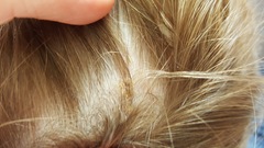 Does anyone know what this is on my sons head?