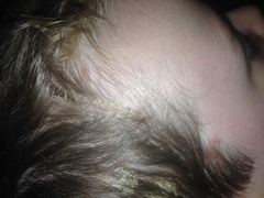 Does anyone know what this is on my sons head?