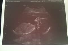 Due February 2017 - thread #7