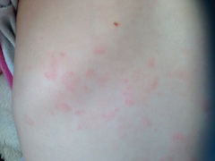 Calling the docs for toddler rash (image attached)