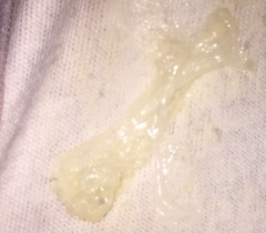 Is this my mucous plug **warning, contains graphic picture - title edited by MNHQ**