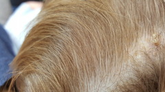 Does anyone know what this is on my sons head?