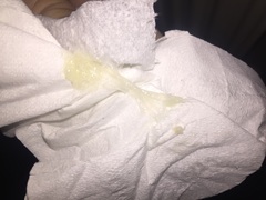 Is this my mucous plug **warning, contains graphic picture - title edited by MNHQ**