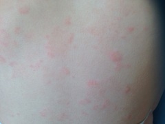 Calling the docs for toddler rash (image attached)