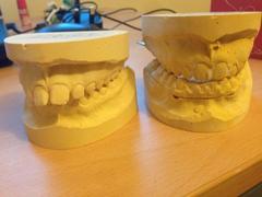 Functional orthodontic appliances on ds..tell me it gets easier please!