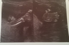 Due February 2017 - thread #7