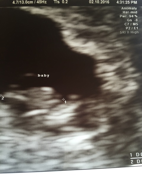 May 2017 Thread #2 - sore boobs, early scans & feeling rather queasy!