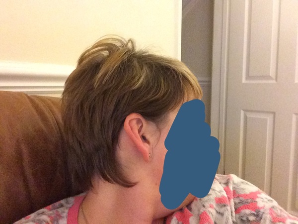 Horrible short hair can't get past the nasty stage (pic)