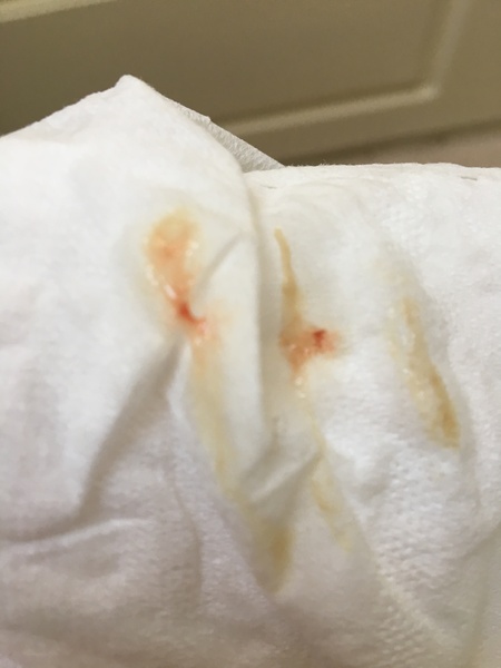 Implantation spotting? *pic in comments!*