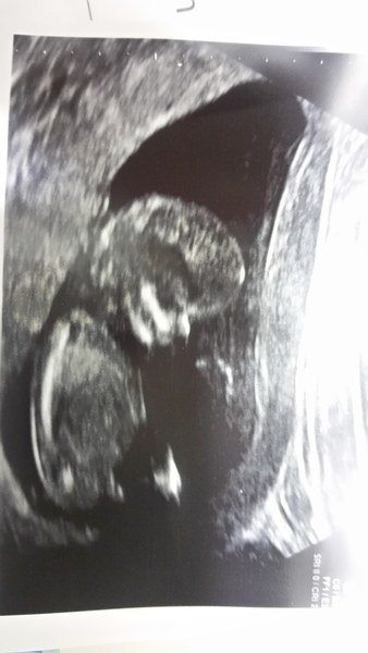 MAY 2017 #3 - Scans and plans !