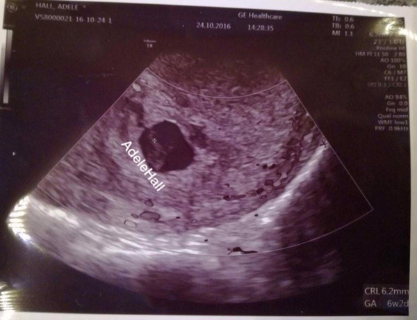 Measuring 2 weeks behind early pregnancy x