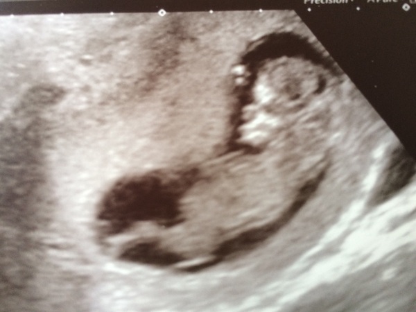 MAY 2017 #3 - Scans and plans !