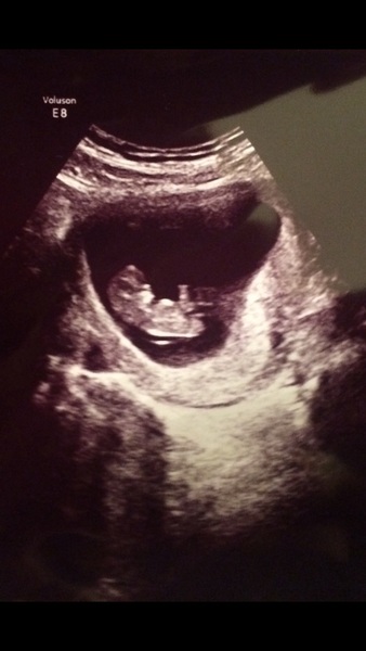 MAY 2017 #3 - Scans and plans !