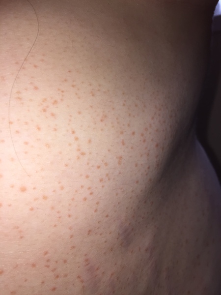 To panic and go to GP for this? (Pics)