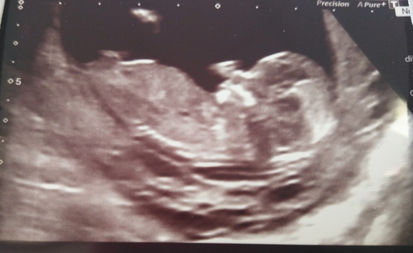 *Just for fun* gender prediction