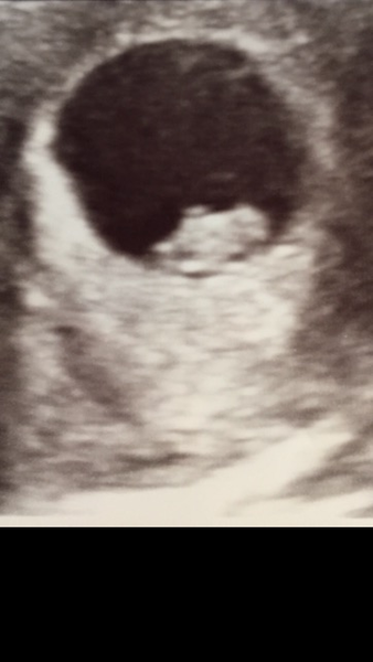 Thread 20 TTC #1 - We. Want. Babies.