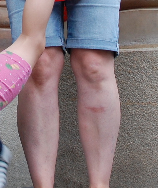 Do some people just not suit shorts? (with photo)