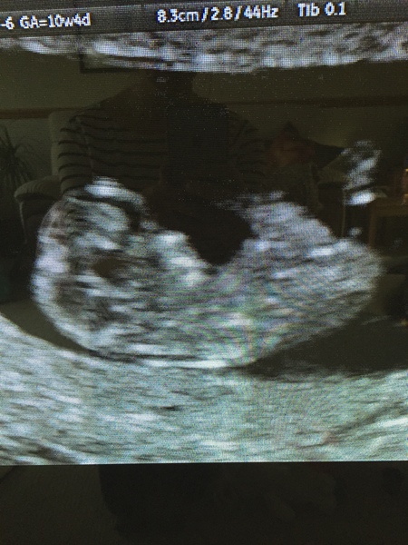 May 2017 Thread #2 - sore boobs, early scans & feeling rather queasy!