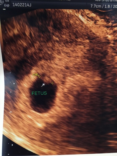 Pregnant and breastfeeding? Come and chat!