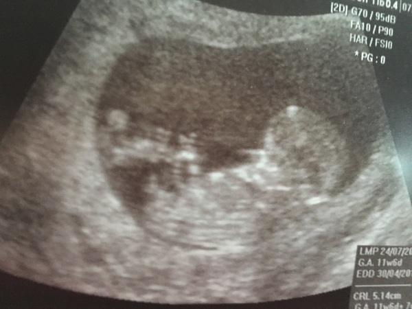 Ttc number 2!