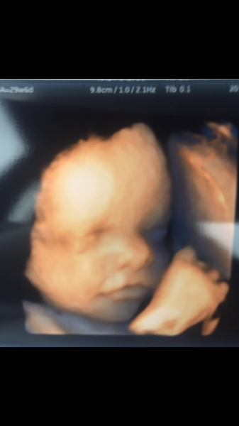 38 weeks