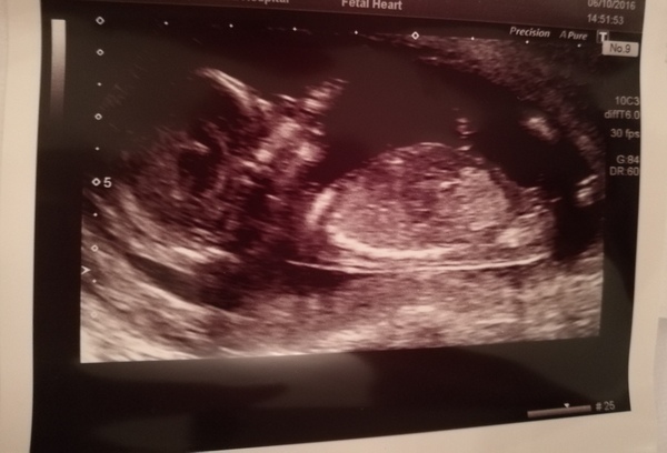 Gender guess please :)